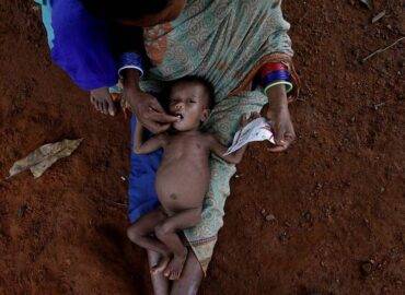 malnutrition- Dawn care foundation