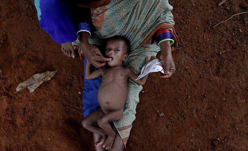 malnutrition- Dawn care foundation